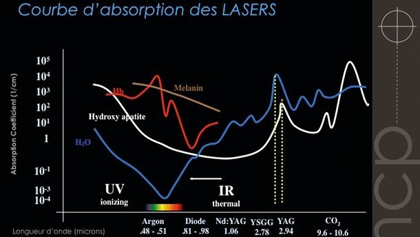 La microchirurgie parodontale d’assainissement: une nouvelle approche avec le laser Erbium-YAG