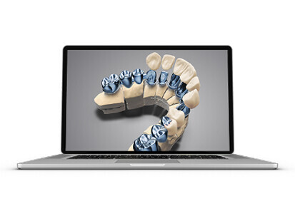 Dental Wings – DWOS Crown & Bridge