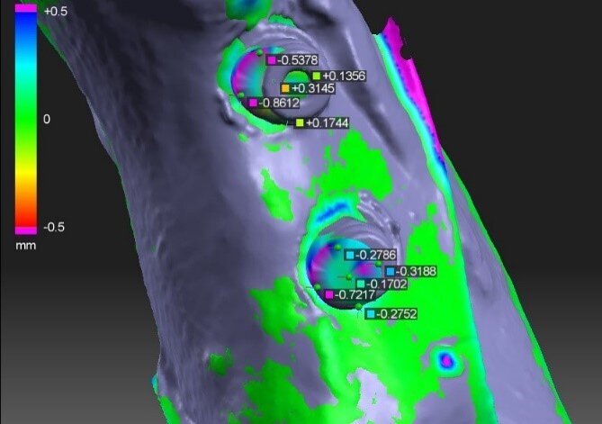 Fig. 3: The placement of measuring points on implants WG01rm and WG01rd. The grey test model with implants was superimposed upon the reference model and deviation levels marked.