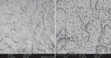 Implantes MIS destacam-se em estudo comparativo de implante de superfície