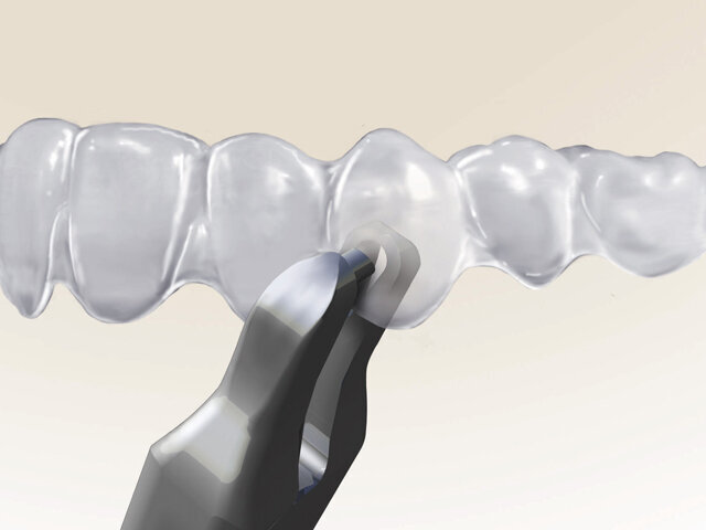 TEAR DROP je navržen k tvorbě výřezů ve tvaru slzy na hranách fóliových aparátů pro zavěšení ortodontických elastických tahů.