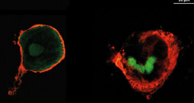 Neue Implantat-Beschichtungen zur Risikominimierung