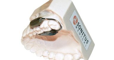 Neues Hörgerät überträgt Geräusche über die Zähne