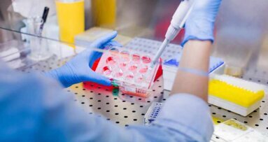 Förderung für Projekt zu parodontalen Mesenchymalen Stammzellen