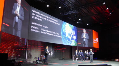 El potencial de crecimiento de la implantología es inmenso, considerando que solo un 1.5% de los dientes perdidos se reemplazan con implantes.