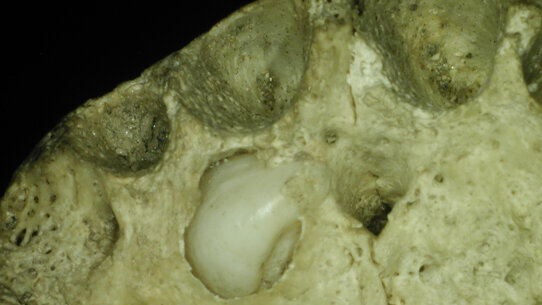 Un caso di iperdontia in un reperto di epoca tardo romana proveniente dalla grotta-ossario di Susa (To)