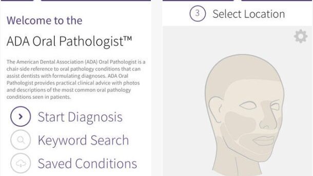 App helpt tandarts bij diagnose orale pathologie