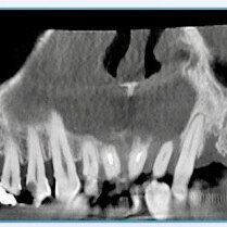 Protocollo SKY fast & fixed