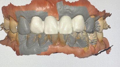 传统牙医的数字化转型：掌握关键的十大要点”