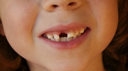 Meeste kinderen ervaren verlies eerste melktand positief