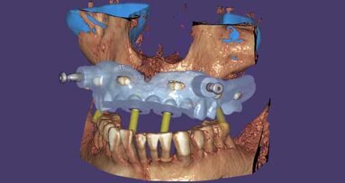 Novo exoplan 3.0 Galway agora disponível