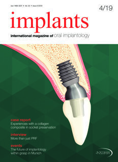 implants international No. 4, 2019 implants international No. 4, 2019
