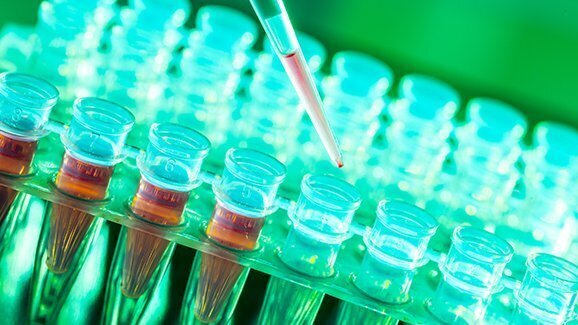 咽喉癌症：新型血样化验技术可以提早发现风险