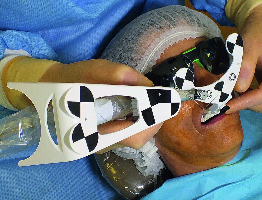 Fig. 4: Calibration of drill axis.