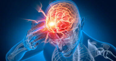 Schlechte Mundgesundheit als Risikofaktor für Schlaganfälle und Herz-Kreislauf-Ereignisse