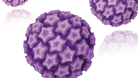 Oral cancer on the rise in the US; Americans unaware of major risk factors