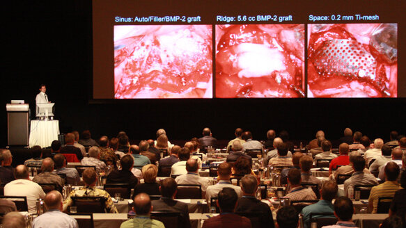Clinicians from around the world gather for Global Bone Grafting Symposium