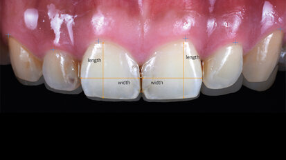 Short cut in the digital fast track