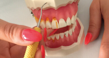 La fototerapia Bioptron: nuovi scenari  per la sindrome del tunnel carpale