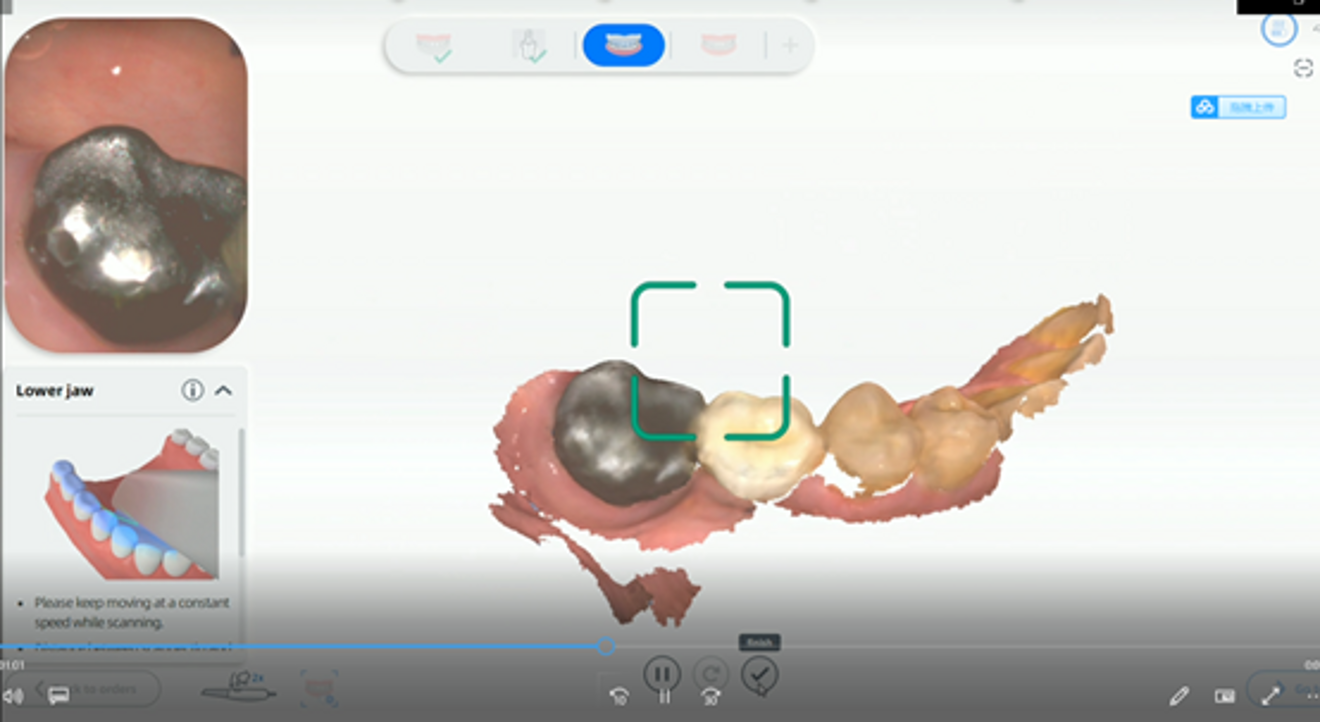 Fig. 5: Scan of the metal crown.