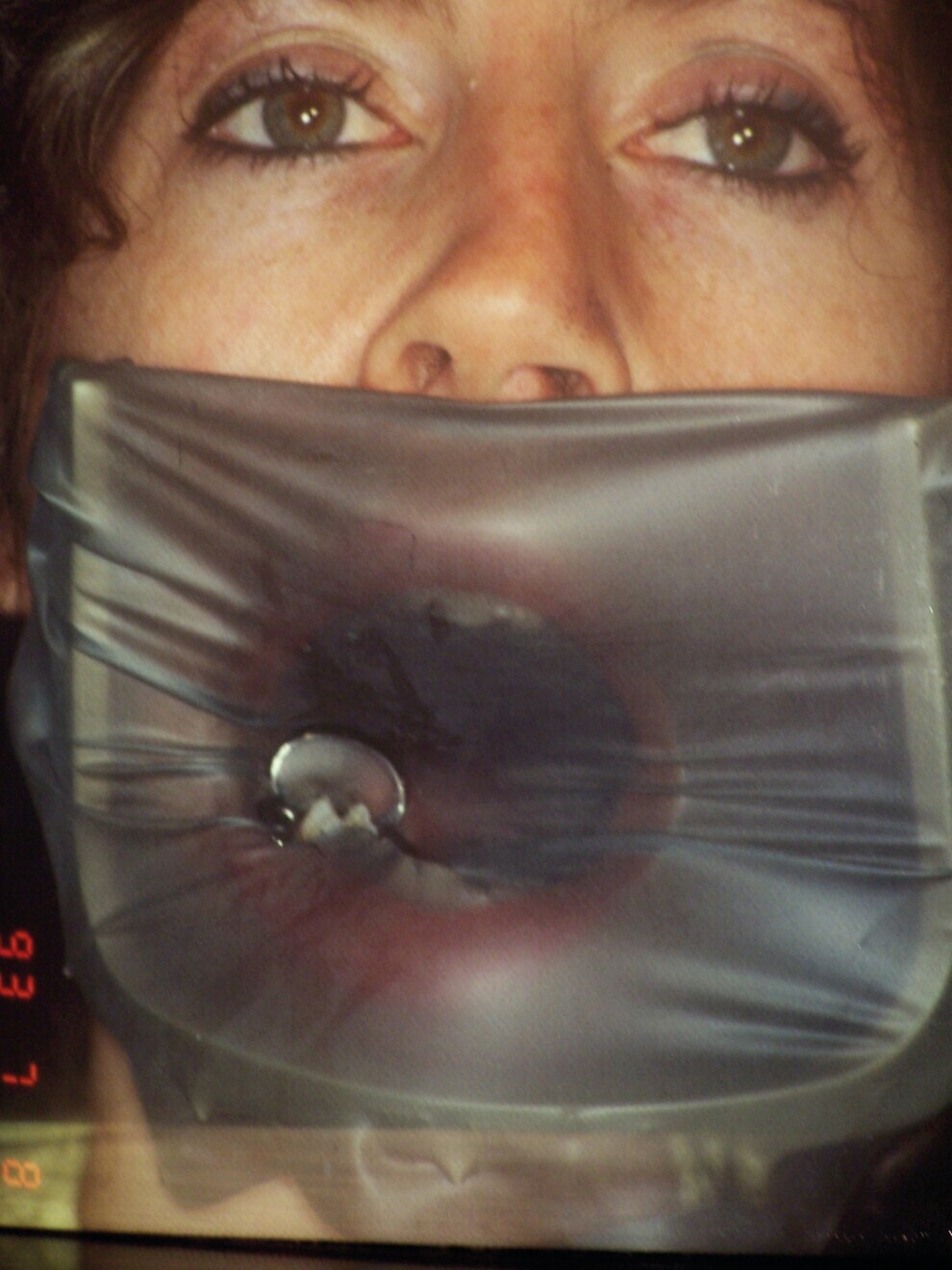 Fig. 1 : Digue en place. 