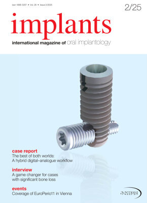 implants international No.2, 2025 implants international No.2, 2025