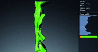 Il ruolo dell’Odontoiatria nella medicina del sonno