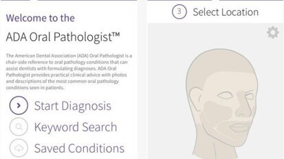 App helpt tandarts bij diagnose orale pathologie