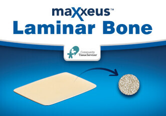 Maxxeus Laminar Bone