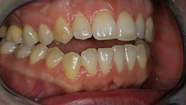 Ästhetik als „Abfallprodukt“? Die Geschichte einer schmerzhaften Odyssee.