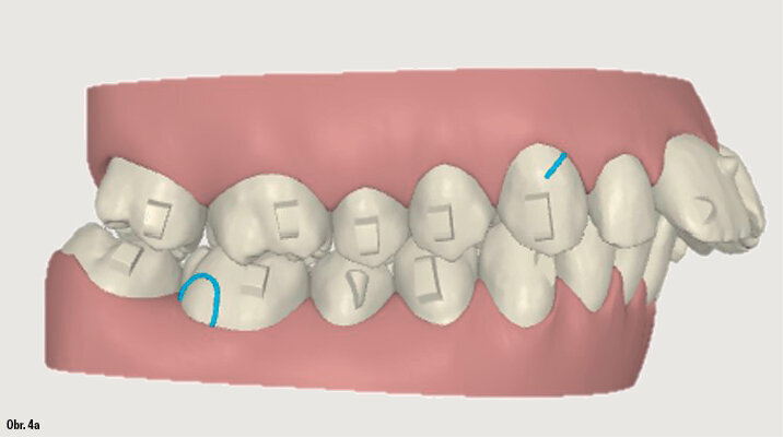 Kazuistika - popis v textu