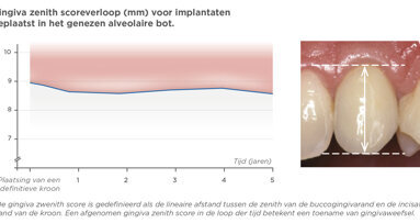 Resultaten die gemoedsrust geven