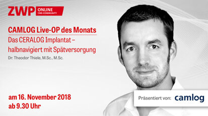 CAMLOG Live-OP am 16. November: Registrieren & CME-Punkt sichern CAMLOG Live-OP am 16. November: Registrieren & CME-Punkt sichern