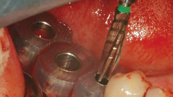 Misch Institute offering two of its most popular courses in one weekend