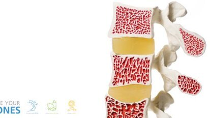 Drei Schritte zu unzerbrechlichen Knochen Drei Schritte zu unzerbrechlichen Knochen