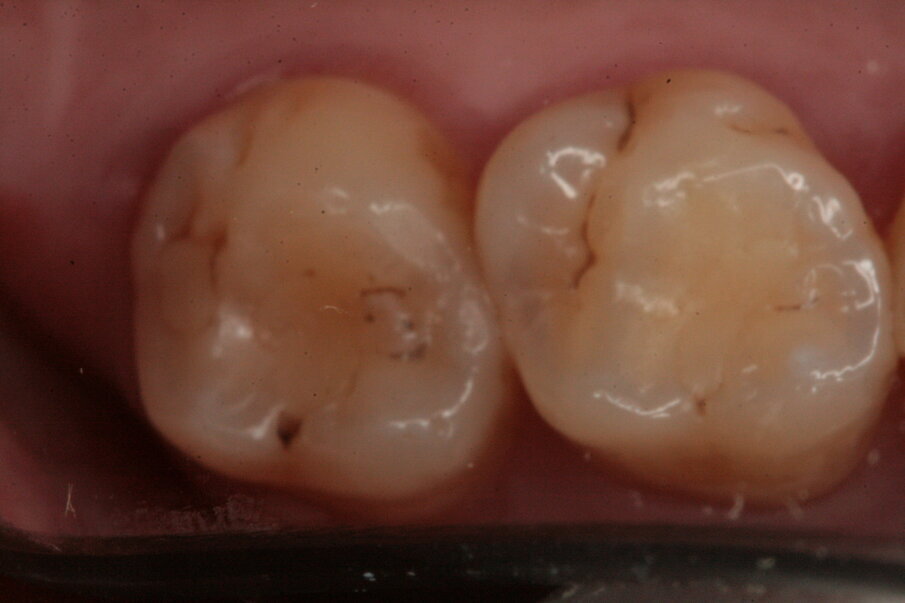 Fig. 12_Restauri ultimati.