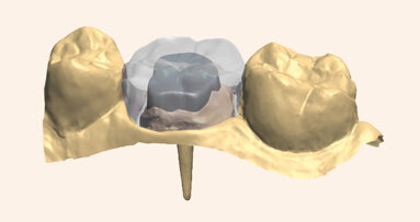 Solution de conception de pivots performante
