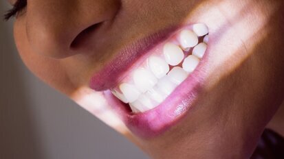 Paski wybielające bez nadtlenków coraz popularniejsze wśród pacjentów