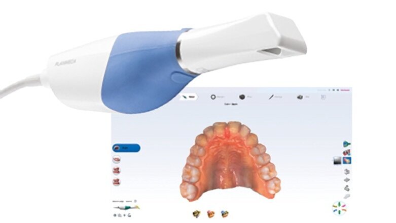 Planmeca Emerald S: escáner de alta velocidad que es fácil de usar