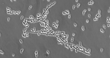 Researchers identify role of mouth cells in Candida infection