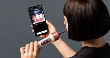Inteligencia artificial para el cepillo dental
