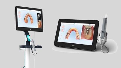 Tecnologías y características de los escáneres intraorales (1)  