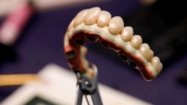 Kompleksowe postępowanie w leczeniu implantologicznym szczęki z zastosowaniem CBCT i CAD/CAM – część 2