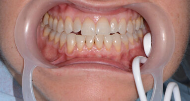 “Ergonomia Odontoiatrica”, benessere per il paziente e per il team-work