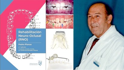 Por una actualización de la Rehabilitación Neurooclusal de Pedro Planas
