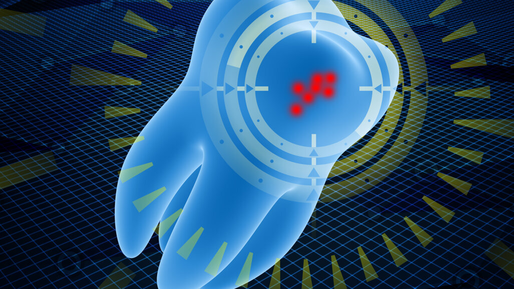 L’imaging a infrarossi a breve lunghezza d’onda mostra il potenziale per il rilevamento di lesioni cariose secondarie