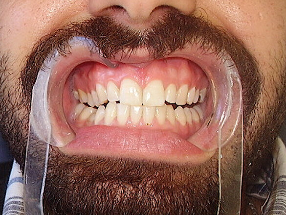 Figura 5. Situación final.