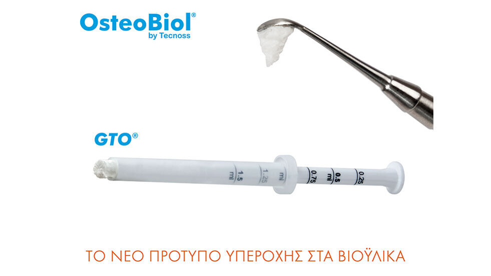 GTO® Το νέο πρότυπο υπεροχής στα βιοϋλικά GTO® Το νέο πρότυπο υπεροχής στα βιοϋλικά