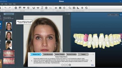 Ormco Custom: It’s all about profitability Ormco Custom: It’s all about profitability
