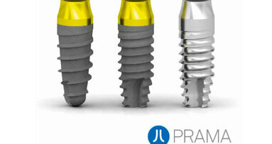 Grande attesa per l’impianto ideato dal dott. Loi con Sweden & Martina